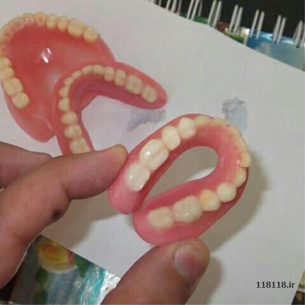 ساخت دندان ژله ایی با مواد ژاپنی و هلندی
